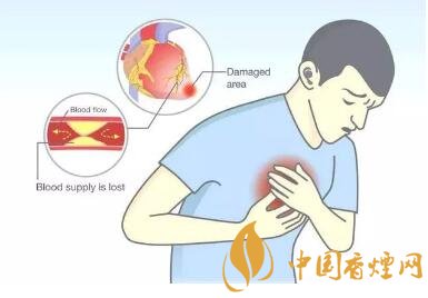 吸煙的兩大主要危害 拒絕健康被煙沒!